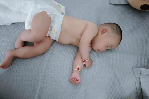 诸城宝宝脸上有白色斑块